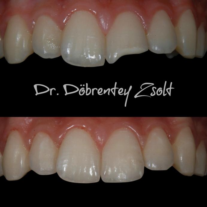 dr. Döbrentey Zsolt esetbemutatás