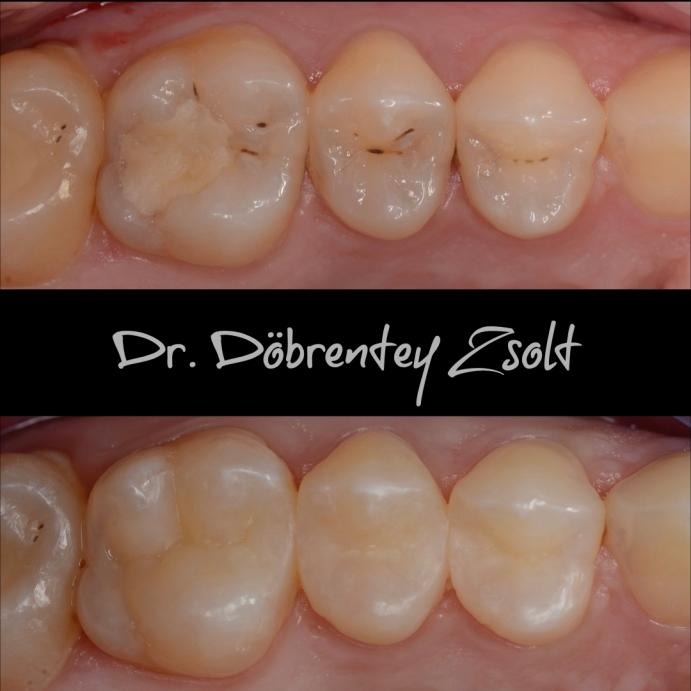 dr. Döbrentey Zsolt esetbemutatás