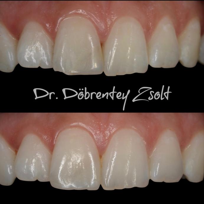 dr. Döbrentey Zsolt esetbemutatás