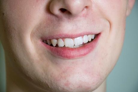 fogszabályozási eset